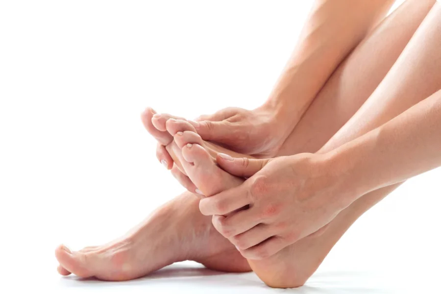 Cracked Heels